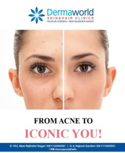 Acne Treatment in Delhi