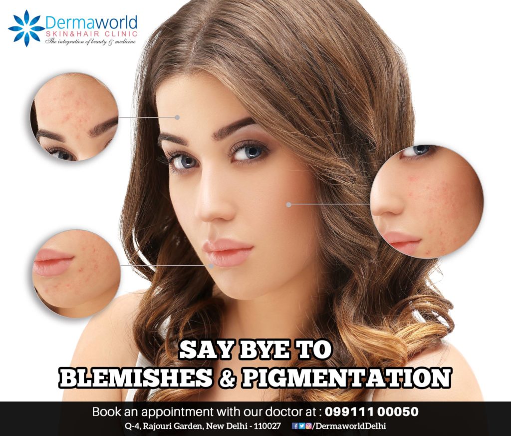 Say bye to pigmentation & blemishes