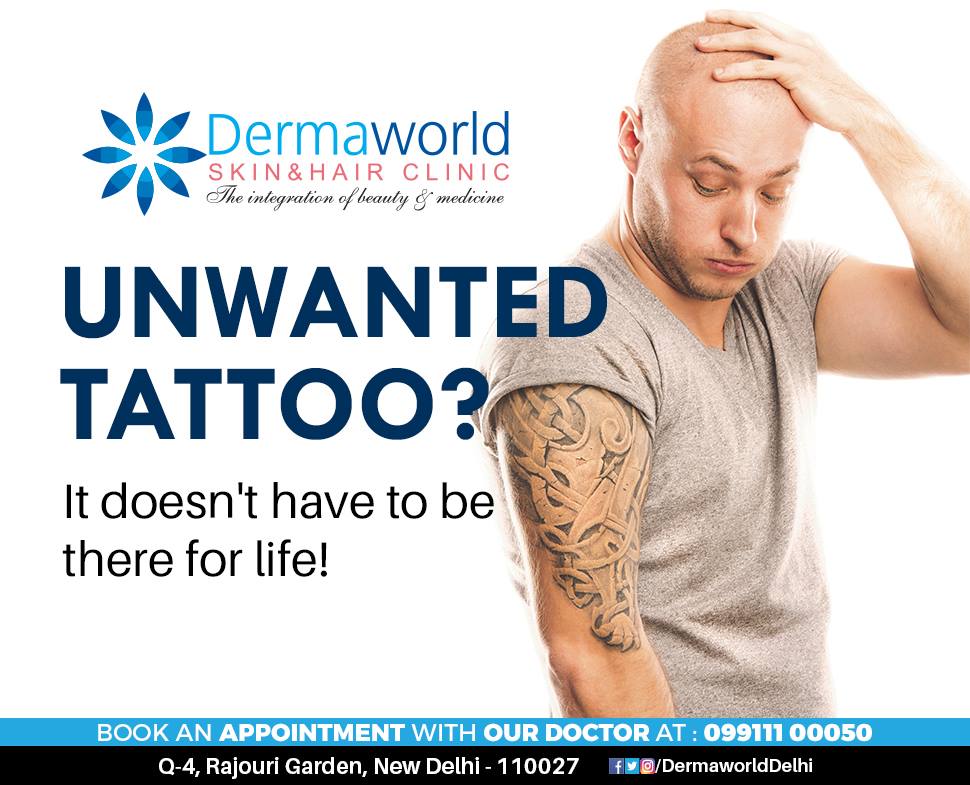 Best laser tattoo removal in delhi