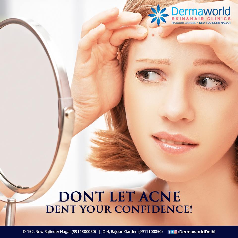 best skin specialist for acne in delhi