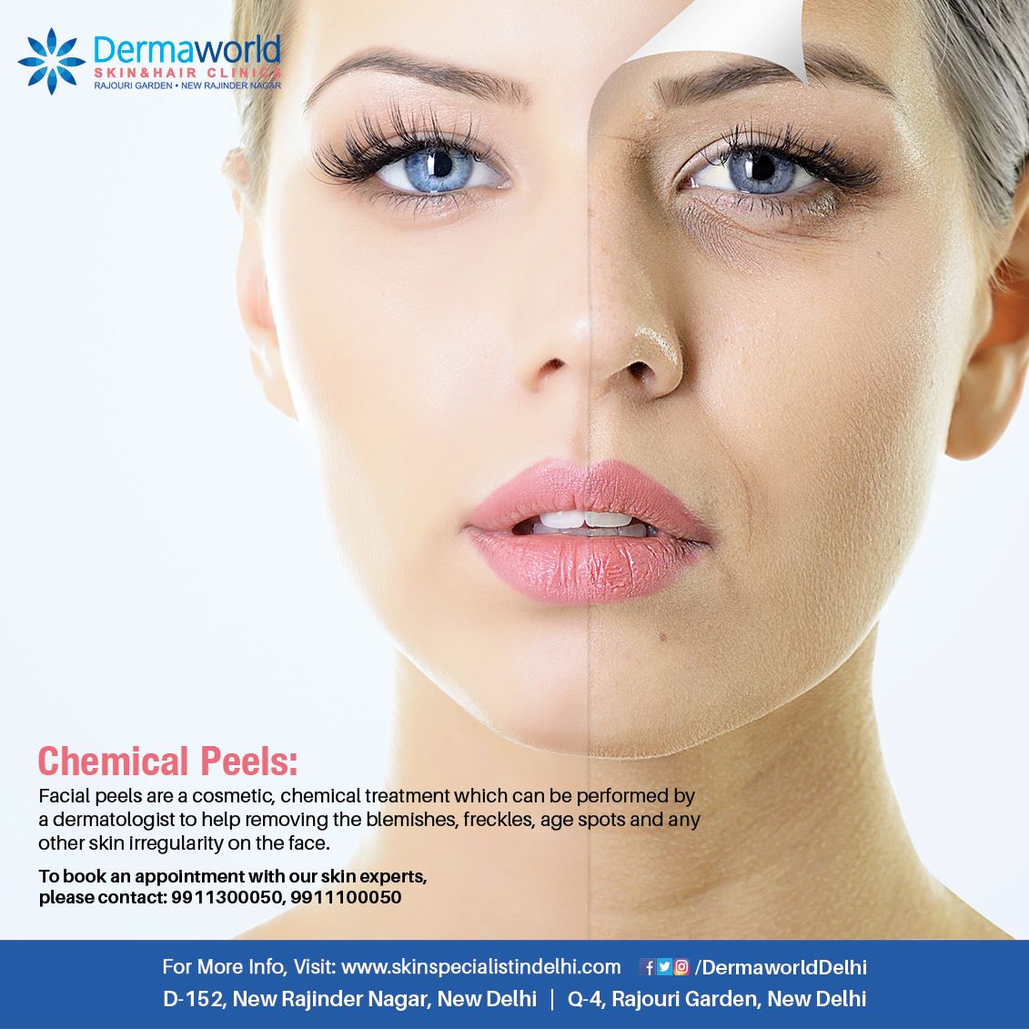 best skin clinic in west delhi