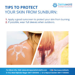 Protect Your Skin From Sunburn