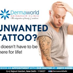 Best laser tattoo removal in delhi
