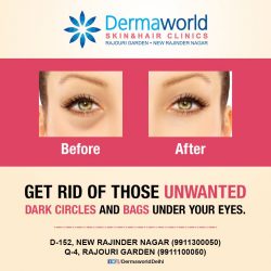 Under eye dark circle treatment in delhi