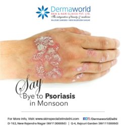 Best skin specialist for psoriasis treatment